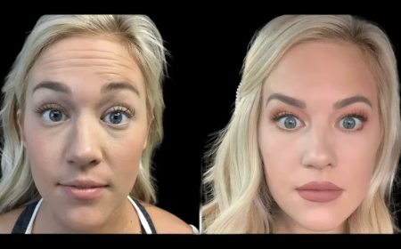 Age Gracefully with Preventative Botox by the Best Plastic Surgeon in dubai