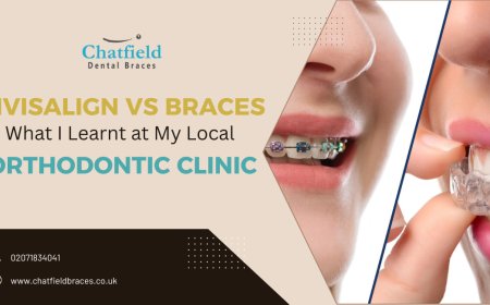 Invisalign vs Braces: What I Learnt at My Local Orthodontic Clinic
