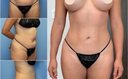 Best Body Contouring Surgeons in Dubai: A Step Toward a Better You