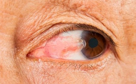 Understanding the Safety Aspects of Laser Eye Surgery