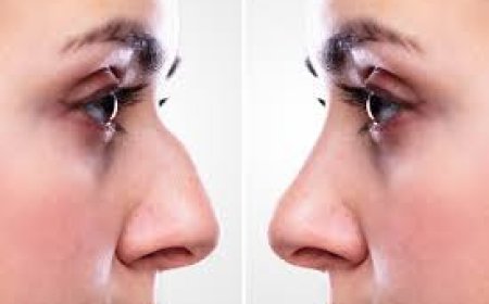 Beyond the Mirror: The Aesthetic and Functional Wonders of Rhinoplasty