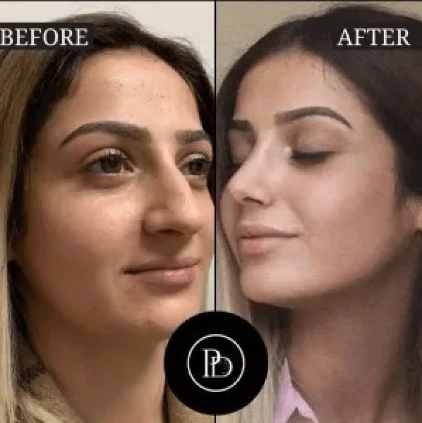 I Tried the Best Aesthetic Clinic in Dubai – Here’s My Before & After