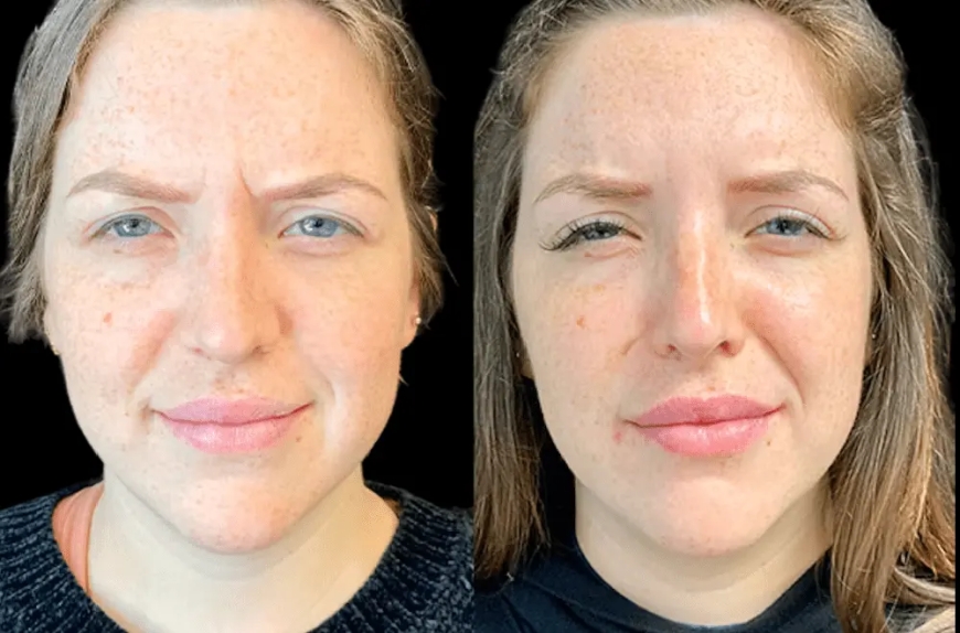 How the Best Aesthetic Clinic in Dubai Helps You Age Gracefully