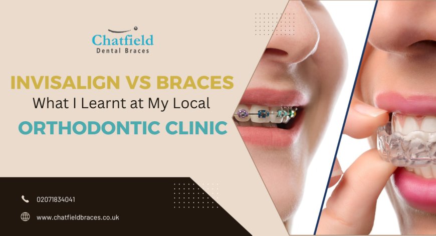 Invisalign vs Braces: What I Learnt at My Local Orthodontic Clinic
