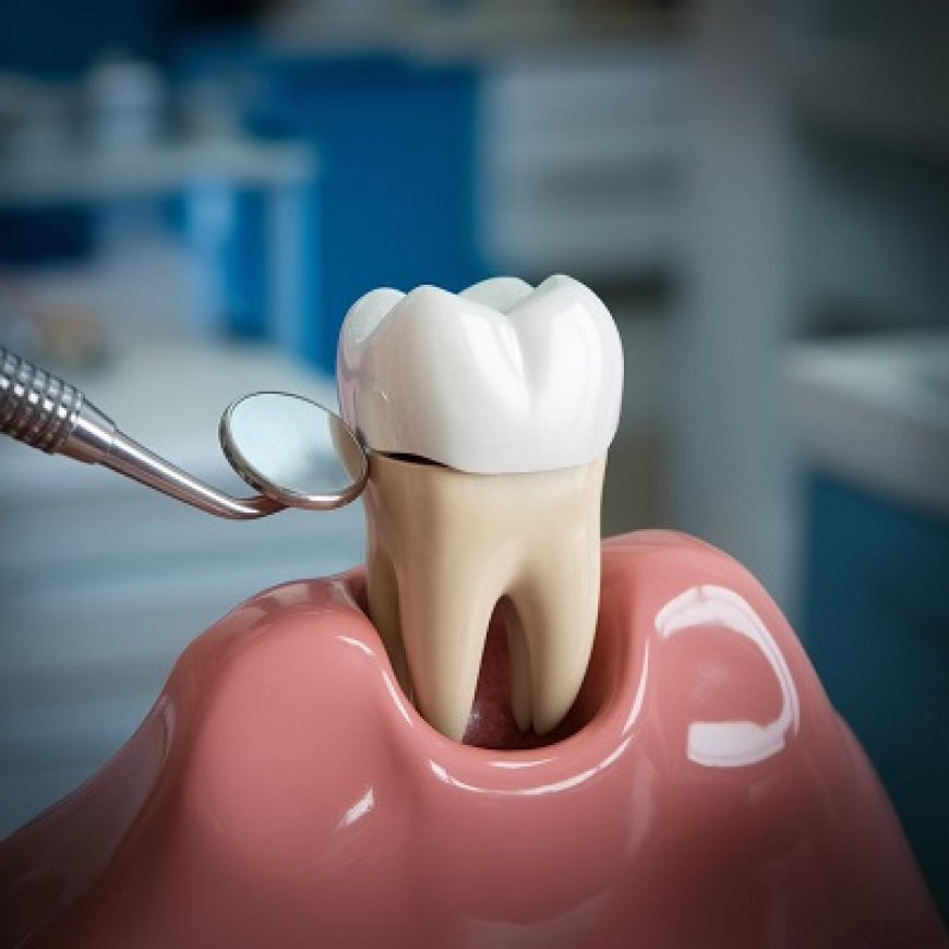 Smile Confidently with Tooth-Colored Dental Crowns