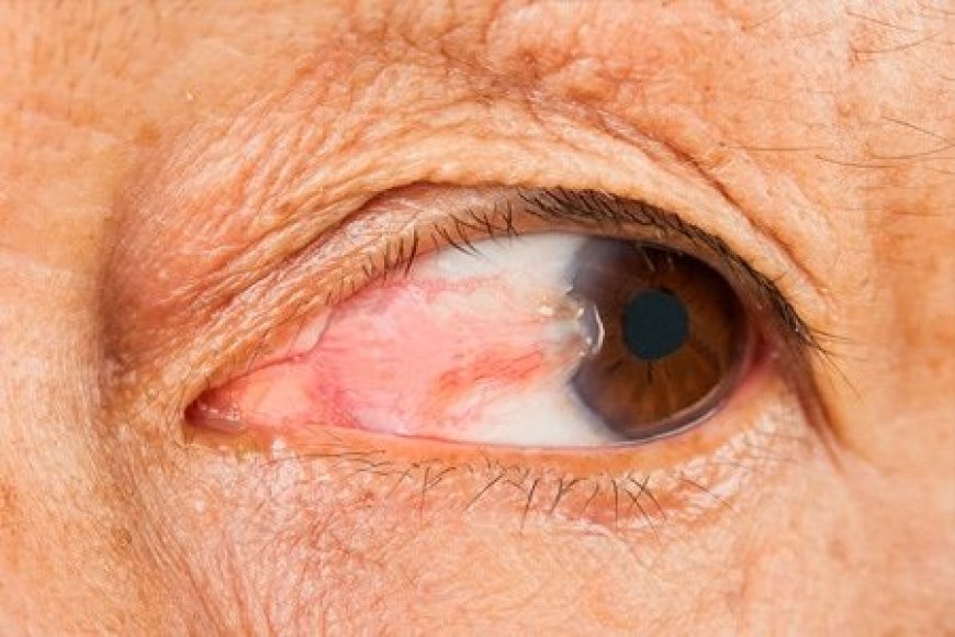 Understanding the Safety Aspects of Laser Eye Surgery